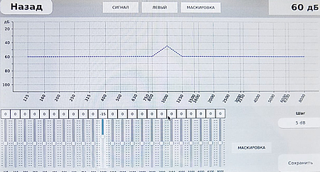 Калибровка аудиометра