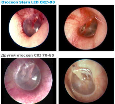 Цветопередача отоскопа Цветопередача отоскопа