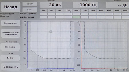 Аудиотест Sisi