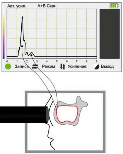 Нет результатов Нет результатов