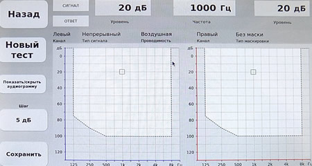Аудиотест ABLB