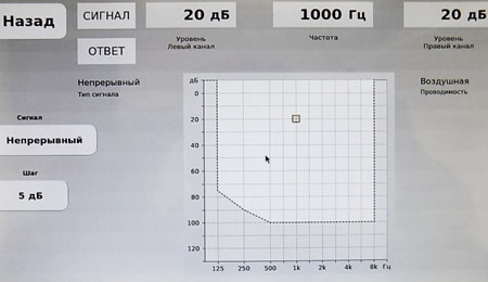 Аудиотест Stenger